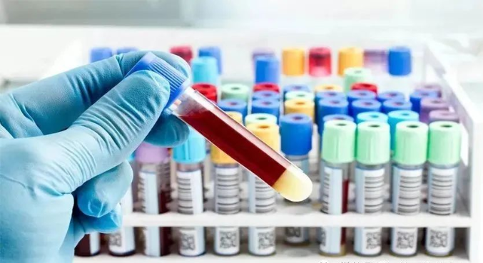 親子鑒定樣本放了一段時間還能用嗎？