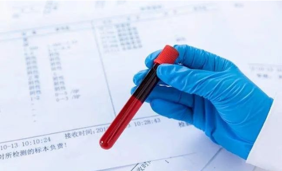 廣東司法親子鑒定大概多少錢？需要哪些手續(xù)？