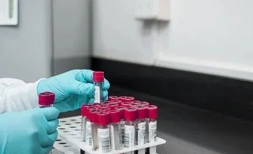 中山親子鑒定多久才能出結(jié)果？