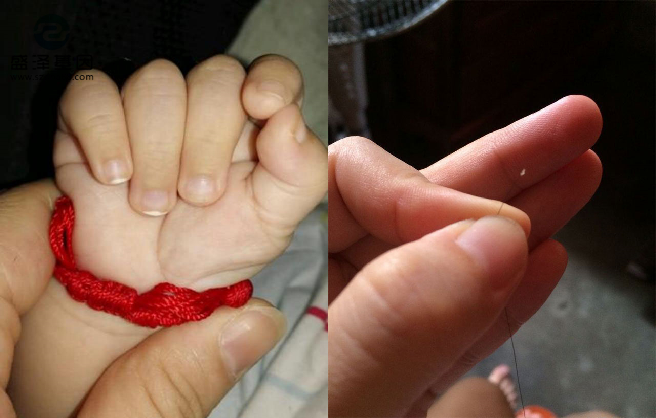 親子鑒定樣本怎么采集？采集頭發(fā)