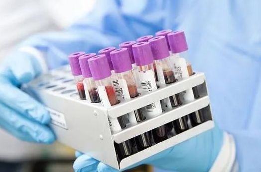 胎兒還沒有生下來(lái)能不能做親子鑒定采集羊水？