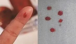 想帶小孩去做親子鑒定該如何取證呢？用紗布或棉簽等采集樣本