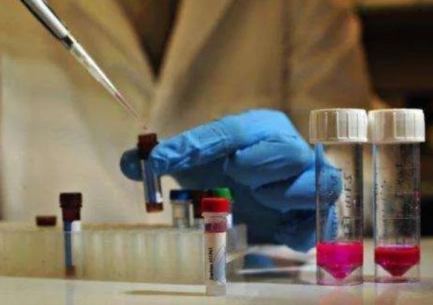 做親子鑒定到底是去醫(yī)院還是去有資質(zhì)的正規(guī)親子鑒定機構(gòu)？