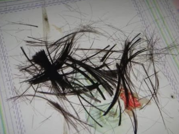 剪下來(lái)的頭發(fā)沒(méi)有毛囊可以做親子鑒定樣本嗎？