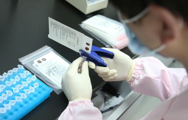 怎么進行親子鑒定最方便？