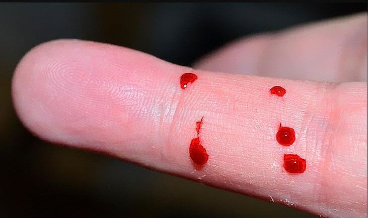 中山東升鎮(zhèn)能不能做親緣親子鑒定？東升鎮(zhèn)姐弟怎么做親子鑒定